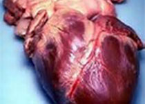 Heart：肝细胞生长因子作为冠心病的生物标志物具有种族异质性！