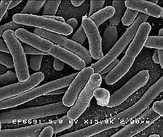 Gut：粪便菌群移植对复发性难辨梭菌感染治疗影响因素