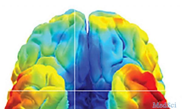 J Neuro Sci: 对癫痫患者的研究发现了大脑如何<font color="red">记忆</font>的线索