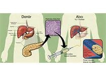 Clin Gastroenterol H：丙型肝炎、<font color="red">糖尿病</font>、肥胖和慢性<font color="red">肾脏病</font>流行的汇合情况分析！