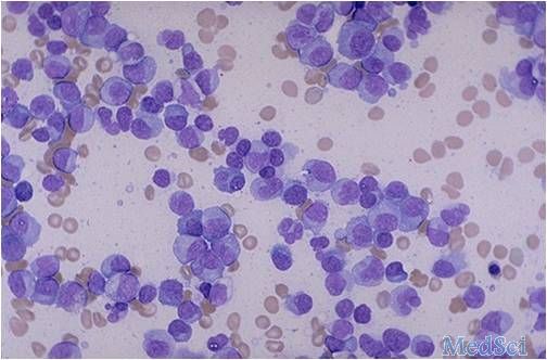 Leukemia：成熟NK<font color="red">细胞</font>比例增加表明慢性粒<font color="red">细胞</font><font color="red">白血病</font>伊马替尼停药成功