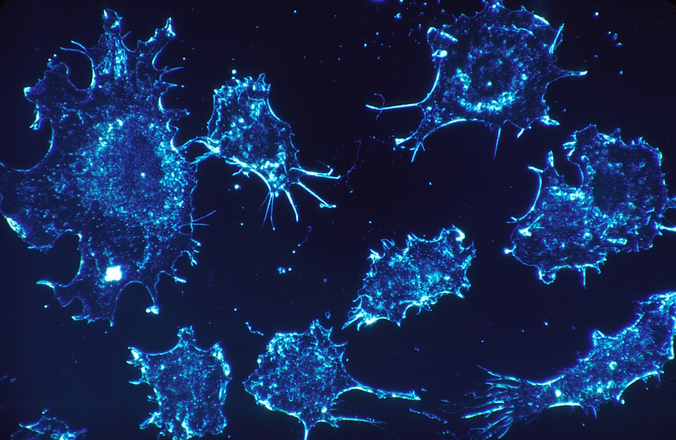 CELL REP：致癌代谢物 2-HG 通过下调 RIP3 促进肿瘤生成