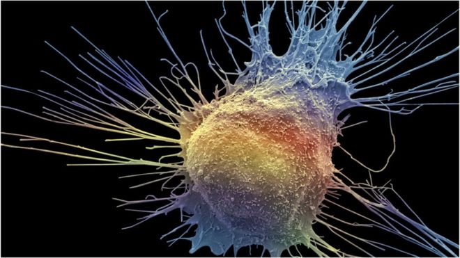 New Engl J Med：前列腺癌新疗法可帮助更多患者