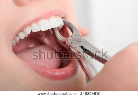 Saudi J Anaesth：上颌牙麻醉使用4%阿替卡还是2%甲哌卡因？