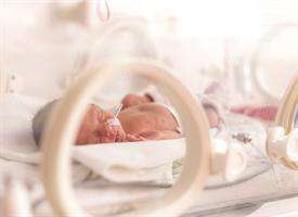 AJRCMB: 早产儿在生命后期可能缺乏关键的肺细胞
