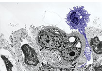 J CLIN ONCOL：III期选择性试验中年龄对lenvatinib治疗放射性碘难治性分化型甲状腺癌疗效和安全性的影响