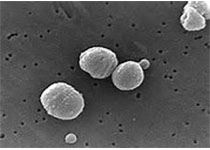 加拿大卫生部批准了3M李斯特菌属试验