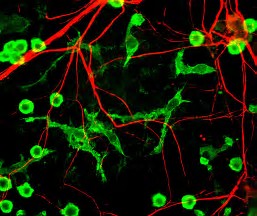 Immunity：miRNA对于神经的早期发育至关重要