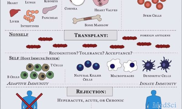 Science Immunology :专家发现器官排斥的启始分子