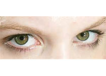 Int Ophthalmol. ：用于近视的激光原位角膜磨镶术后眼内压和“眼内压常数”的样本预测模型