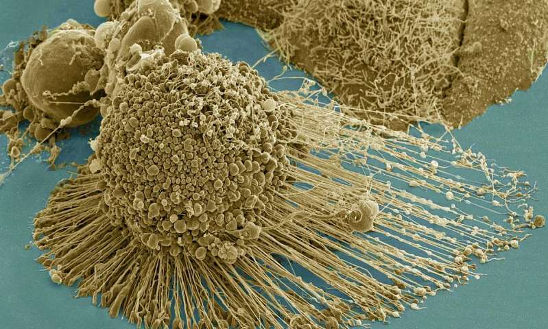 PNAS：纳米棒治疗：打断癌细胞的“腿”，成功抑制癌症扩散！