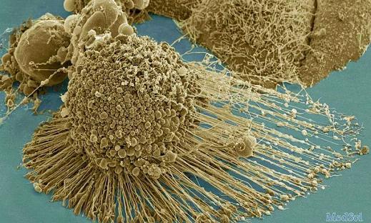 PNAS阻止癌症转移新武器：<font color="red">纳米</font>材料+激光打断癌细胞的“腿”
