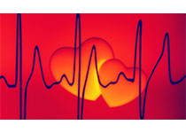 Eur Heart J：高血压前期和空腹血糖受损与新发房颤相关吗？