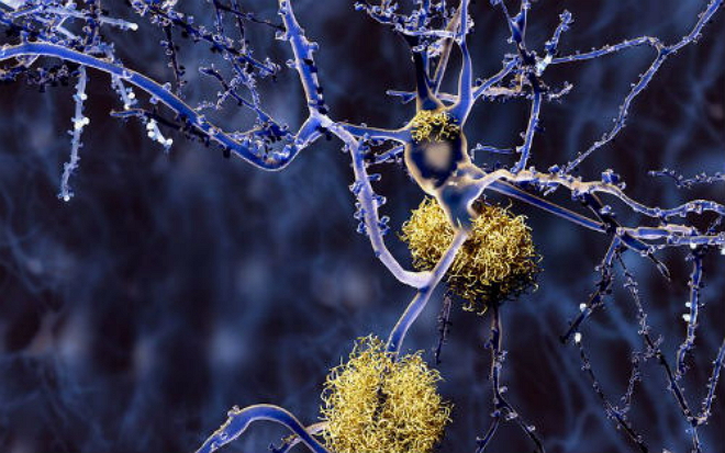 Neuron:大脑“清道夫”过度活跃，加剧老年痴呆