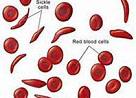 Blood：输注红细胞或血小板对出血的影响以及出血的相关参数。