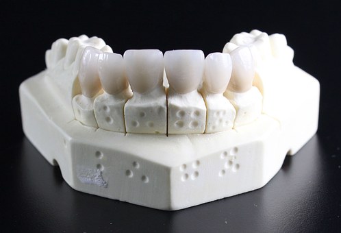 Int J Implant Dent：自体骨移植是口腔种植<font color="red">前牙</font>槽嵴增量的“金标准”