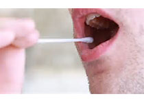 J Dent Res：白色念珠菌在牙科丙烯酸表面的早期黏附