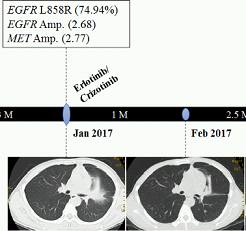 我国学者在《Annals of Oncology》发表高分SCI文章，展示非小细胞肺癌的精准治疗方案
