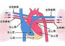 Int J Cardiol：<font color="red">法</font><font color="red">洛</font><font color="red">四联</font><font color="red">症</font>患者右心房功能异常!