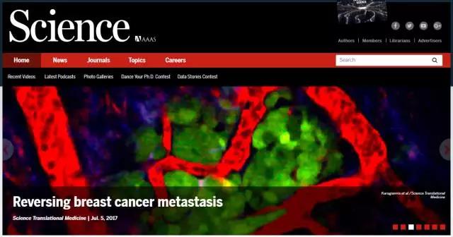 Sci Transl Med：颠覆常识！化疗反而增加了乳腺癌转移风险