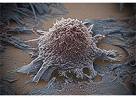 Brit J Cancer：紫外损伤导致恶性黑色素瘤的机制研究