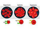 Haematologica：ALK阳性间变性大<font color="red">细胞</font><font color="red">淋巴瘤</font>的特征是重排ALK基因拷贝数增加