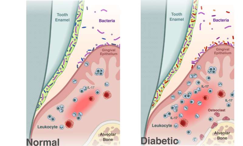 Cell Host  Microbe：又一个容易被忽视的糖尿病并发症！