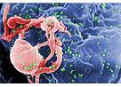 Gynecol Oncol：含贝伐单抗方案在复发性低级别浆液性卵巢癌及腹膜癌中<font color="red">的</font>应用