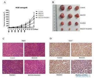 Oncotarget:强<font color="red">磁场</font>科学中心在小细胞肺癌靶向治疗研究中取得进展