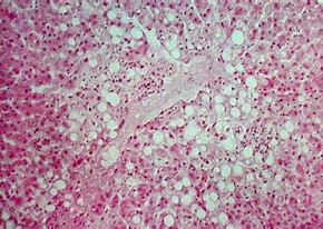 JASN：巨噬细胞-成肌纤维细胞转换导致慢性移植肾损伤的间质纤维化