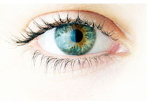 . : 在色素性<font color="red">视网膜炎</font>患者中植入艾哈迈德青光眼瓣膜可以解决由于类固醇引起的眼内压升高的后果！