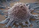 Radiology：高大上的影像基因组学在非小细胞肺癌的应用！