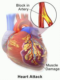 Sci Rep：新发现成功逆转心脏病带来的损伤