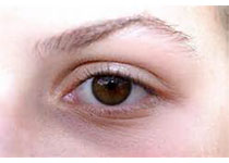 ：<font color="red">病例</font>报告-<font color="red">重症</font>肌无力患者的眼外肌研究揭示潜在眼肌麻痹症治疗方法！