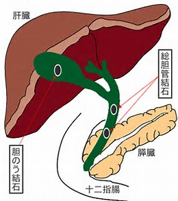 Gastroenterology：胆汁中细胞外<font color="red">囊</font>泡可作为恶性胆道狭窄的标志物