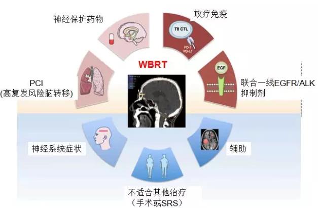 J Thorac Oncol：NSCLC脑转移∣一文掌握现阶段WBRT的地位和应用