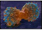 Oncotarget：端粒酶和聚（<font color="red">ADP</font>-核糖）聚合酶抑制剂联合使用能够限制胰腺癌细胞寿命