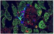 Immunity：免疫细胞在自身免疫<font color="red">性疾病</font>中起着意想不到的作用