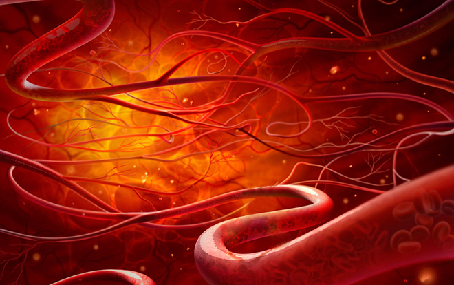 Cell：一个<font color="red">基因</font>变异竟然和五种血管疾病都相关