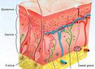J Am Acad Dermatol：嗜酸性筋膜炎的长期预后的危险因素有哪些？