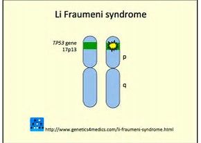 JAMA：关于Li-Fraumeni综合征你知道多少？