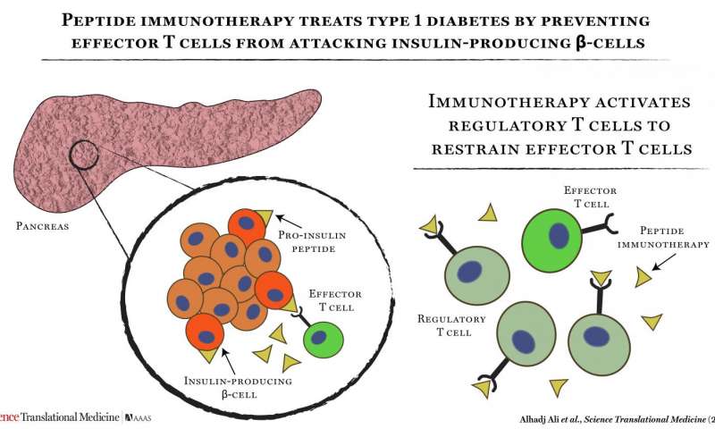 Sci Transl Med:科学家通过“重新训练”免疫系统保护胰腺β细胞来治疗糖尿病！