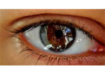 Surv Ophthalmol. ：眼睛红斑痤疮的治疗！