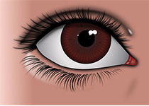 我国原发性<font color="red">开</font>角型青光眼眼颅压力梯度专家共识和建议（2017年）