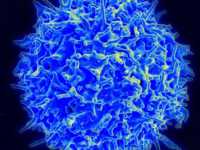Elife：科学家发现开启免疫细胞强大肿瘤杀伤力的重要“开关”！