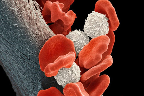 [重复]<font color="red">Cell</font>：维 C 助基因杀掉癌细胞