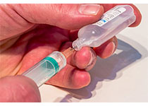 Diabetes Care：控制不佳的2型糖尿病患者采用双醋瑞因治疗的疗效和安全性分析！