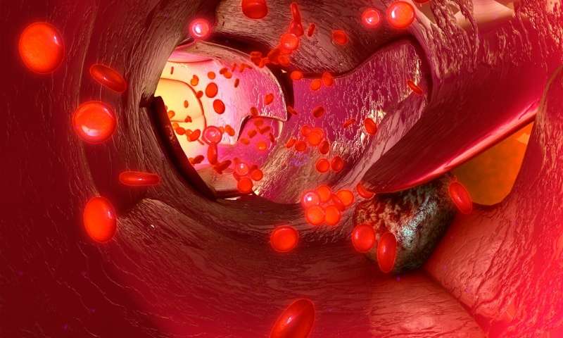 Nat Commun：纳米<font color="red">激光</font>探针：检测并杀灭癌细胞，有效抑制癌症扩散！