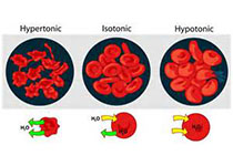 Blood：符合中性进化论的多发性<font color="red">骨髓</font>瘤预后差。