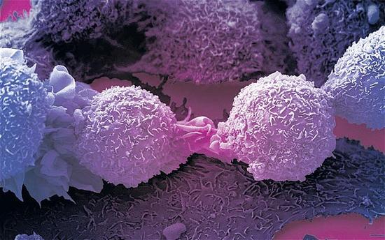 JNCI:早期乳腺癌延长AI辅助治疗与哪些副反应呈正相关？